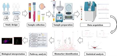 Metabolomics of various samples advancing biomarker discovery and pathogenesis elucidation for diabetic retinopathy